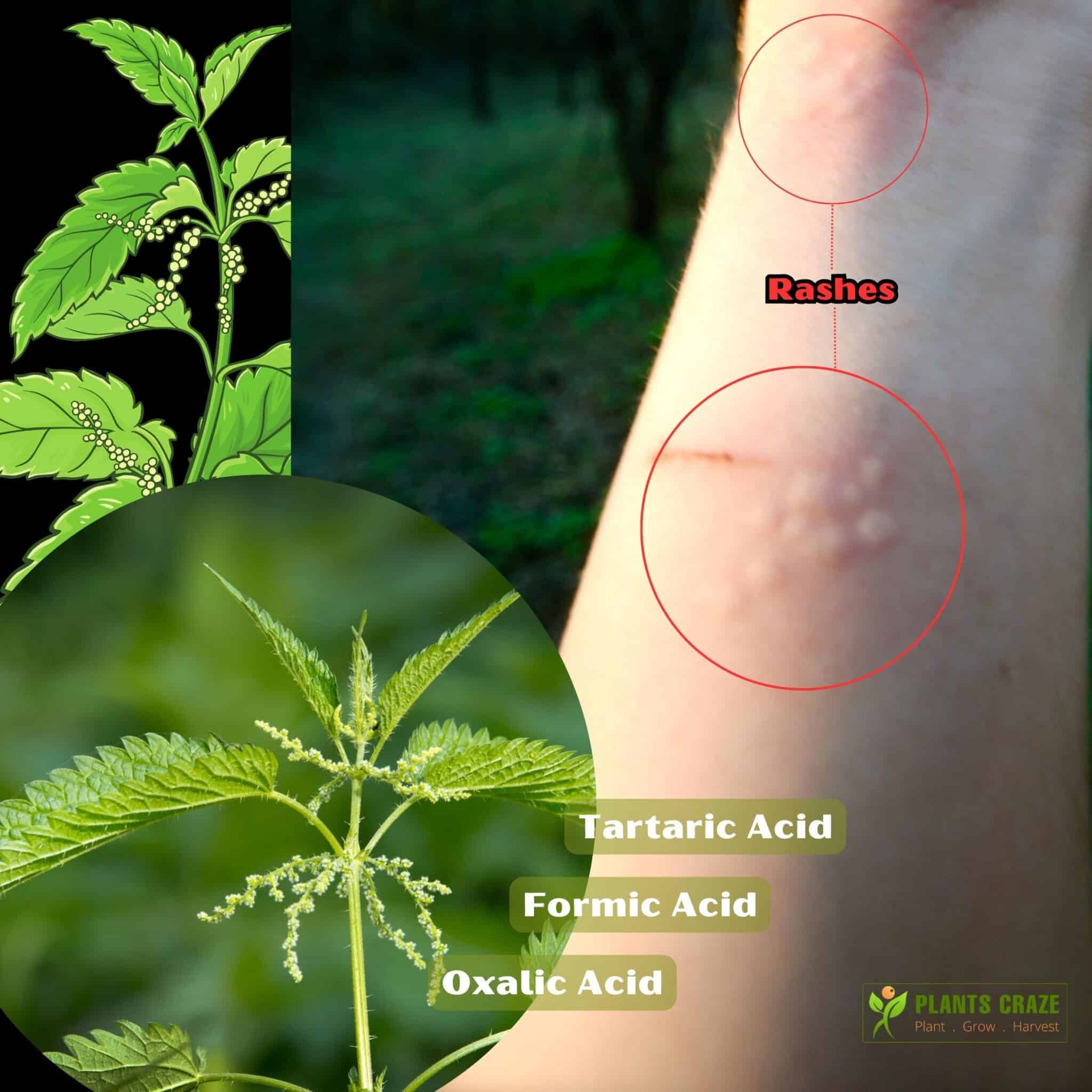 Image illustrates the hazards of Stinging Nettle plant